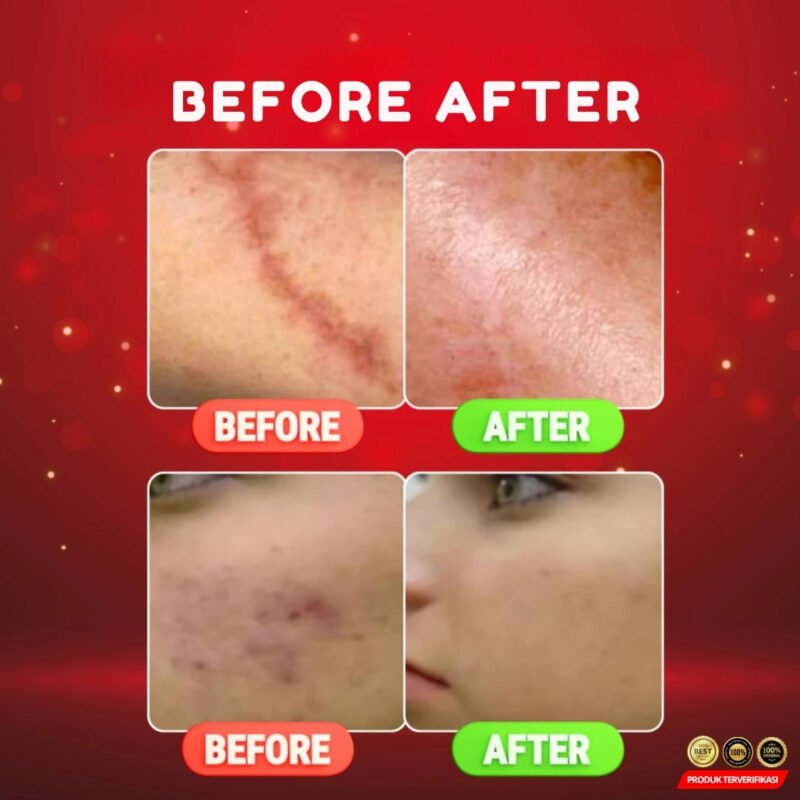 Bio Herbal Meilibahenling Cream Obat Penghilang Bekas Luka Cream Salep Obat Pemutih Kulit Perawatan - Image 2