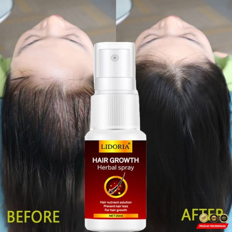 Serum Rambut Rontok Herbal Hair Serum and Treatment Spray 20ml - Image 5