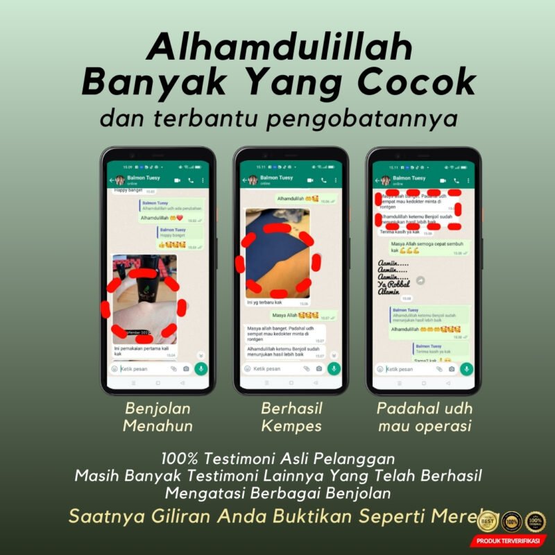 Minyak Gosok Herbal Serbaguna BPOM Asli - Image 2