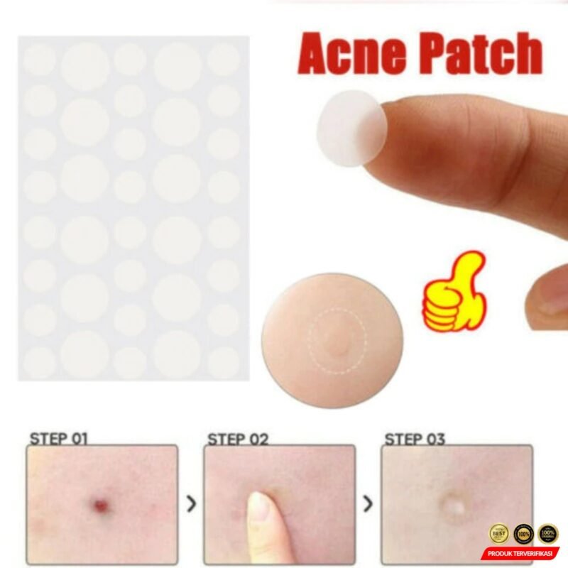 Tag Jerawat Invisible Acne Pimple Skin Patch 36 PCS - Gambar 3