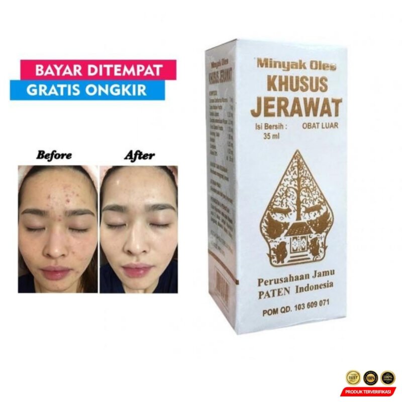 OBAT JERAWAT CAP WAYANG ORIGINAL - Image 3
