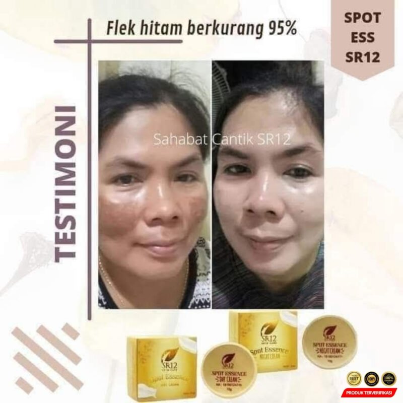 Spot Essence Day Cream Mengatasi Flek Hitam - Image 6