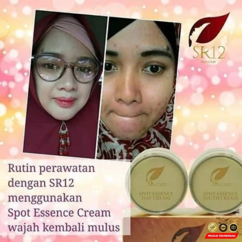 Spot Essence Day Cream Mengatasi Flek Hitam - Image 7