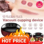 Bekam Cupping
