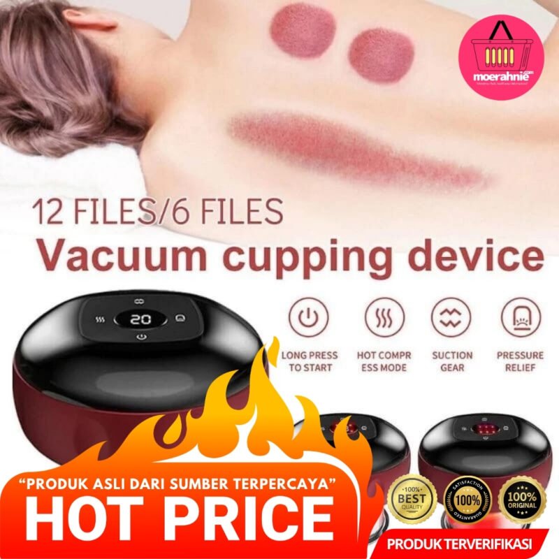 Bekam Cupping