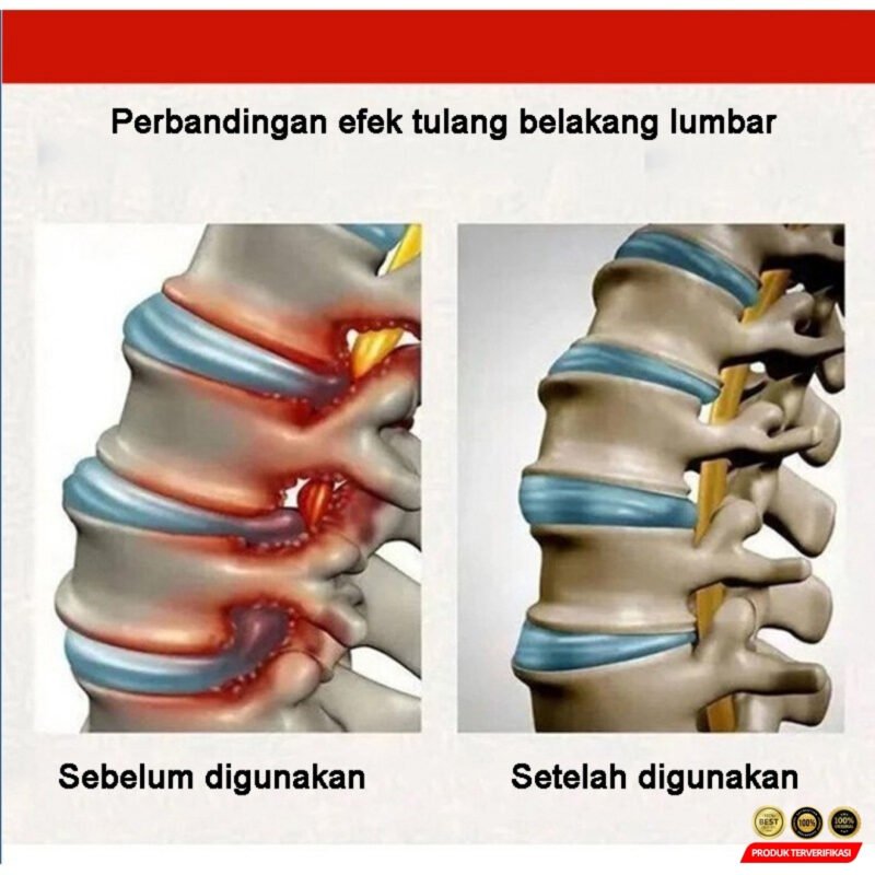 Pereda Nyeri Lumbar Cold Compress Gel Spine Cooling Obat Syaraf Kejepit Obat Sakit Pinggang - Image 8