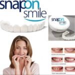 Snap On Smile